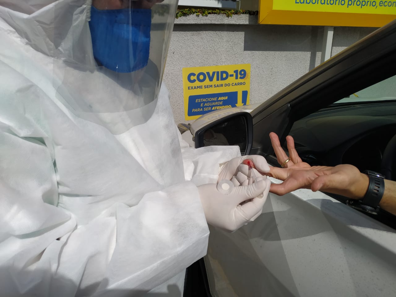 Teste rápido para covid-19 está nas farmácias de Curitiba