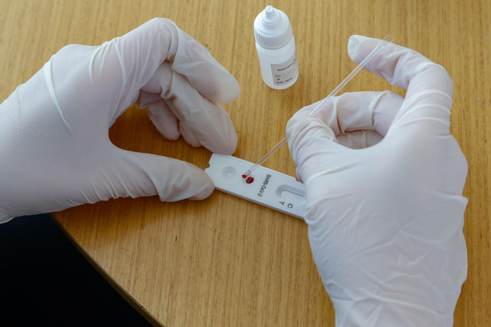 Curitiba vai ampliar testes para covid-19