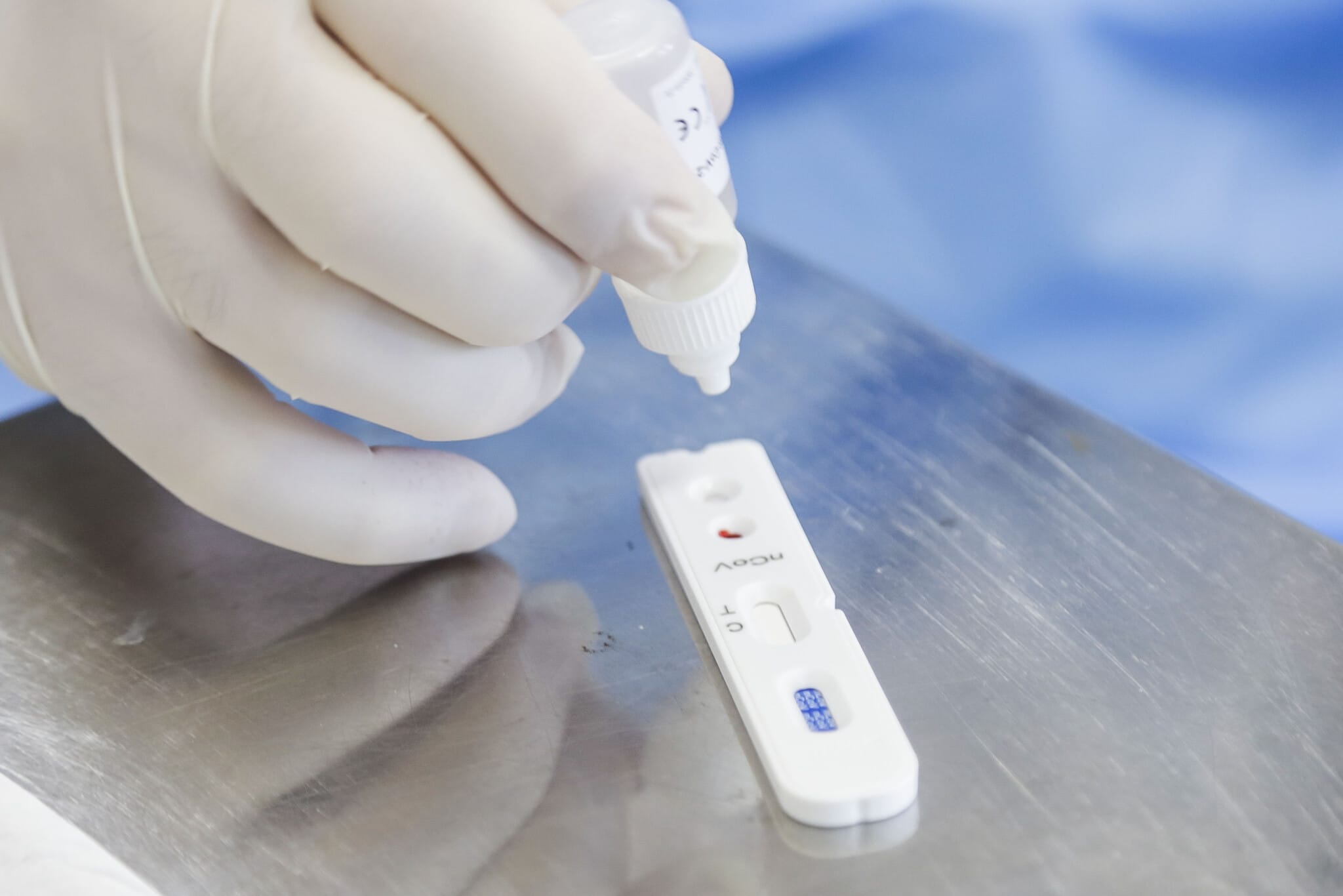 "Situação da pandemia está começando em Curitiba"