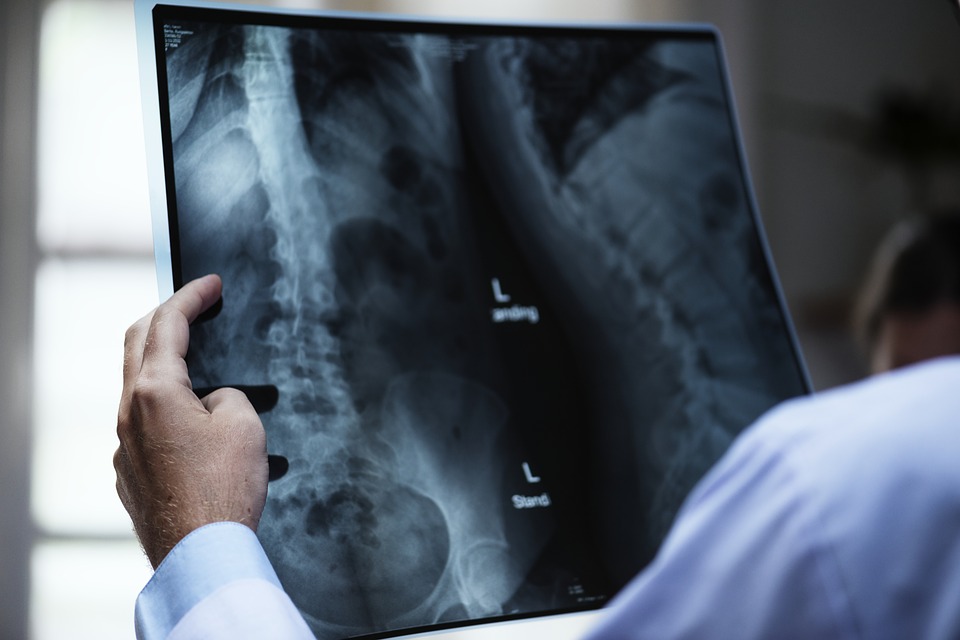 Técnicos em Radiologia de clínicas de Curitiba seguem sem vacina