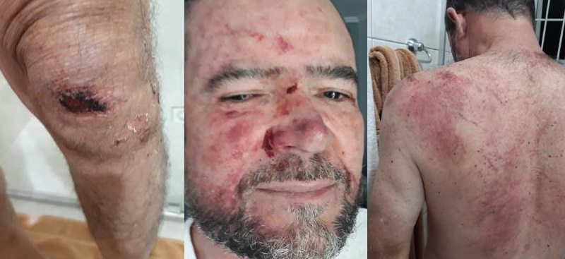Em briga por política, policial bolsonarista espanca professor e é registrado como vítima no B.O.