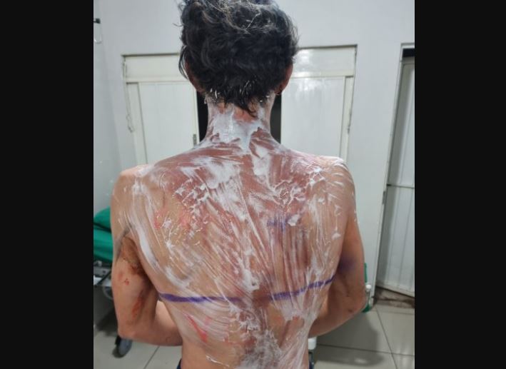 Polícia Civil prende quatro organizadores do trote que deixou estudantes feridos em Palotina