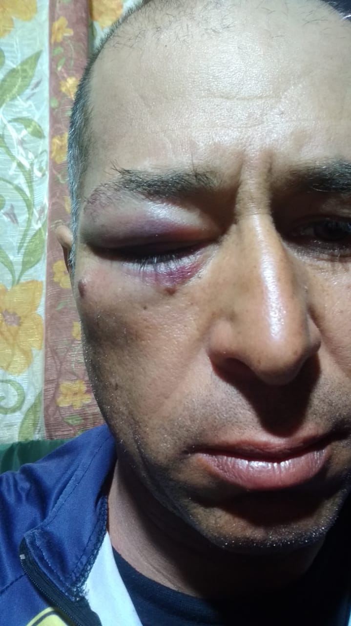 Bolsonarista agride eleitor do PDT em Matinhos