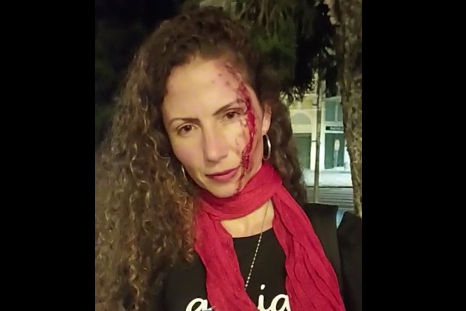Jornalista que usava adesivo de Lula é agredida em Curitiba
