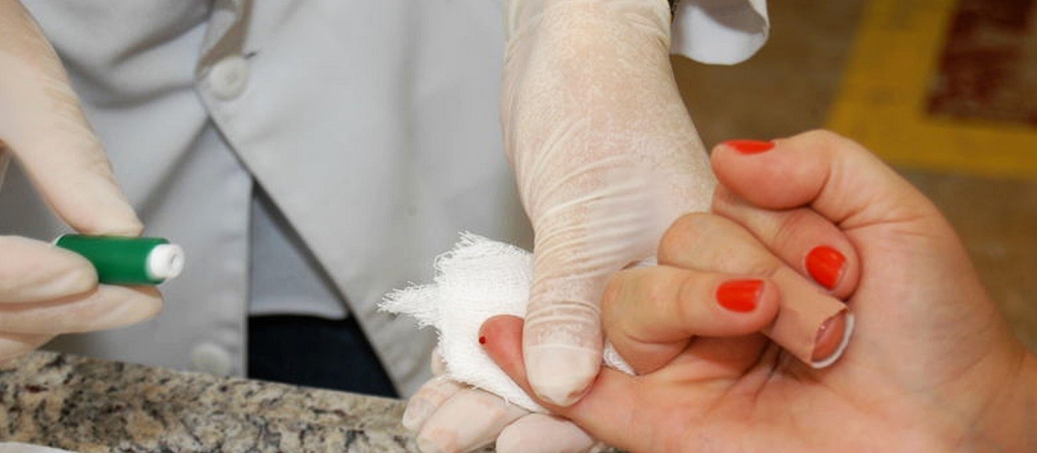 Curitiba passa por um surto de hepatite A; saiba como se prevenir