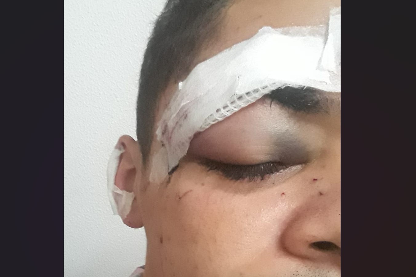 Trabalhador é agredido por cliente em posto de combustíveis; sindicato contabiliza ao menos doze ocorrências no ano