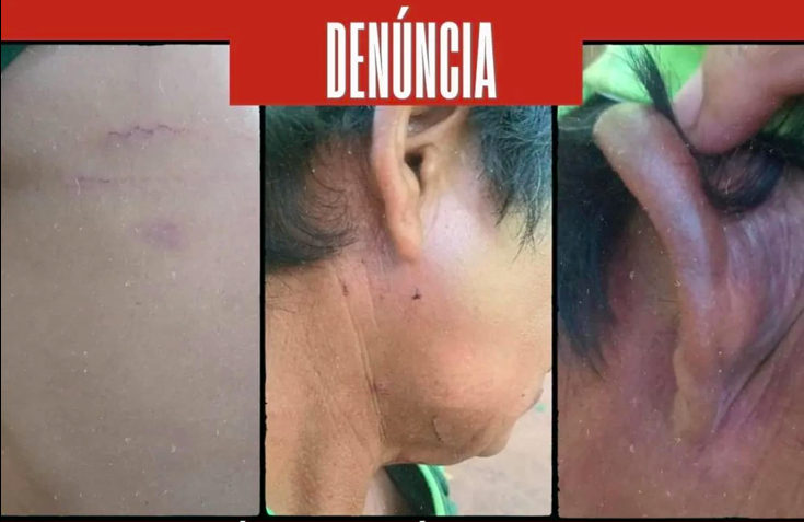 Indígena da etnia Guarani é sequestrado e torturado no Paraná